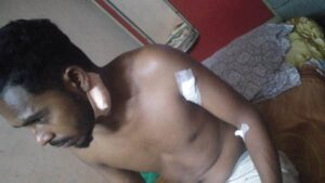 30_03_2024-attack_on_young_man_in_raipur7931723155229764107